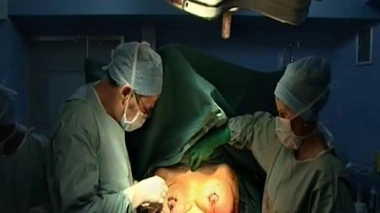 Ch@t : La chirurgie des seins