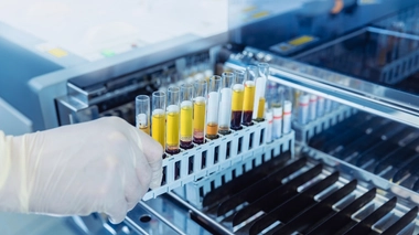 Dans les années 1980, le laboratoire d'oncologie virale dirigé par Luc Montagnier à l'Institut Pasteur se met au travail pour trouver la cause du sida