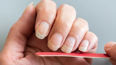 Est-ce grave d'avoir les ongles striés ?