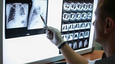 L'osimertinib entraîne des effets secondaires comme une grande fatigue, des rougeurs cutanées ou des diarrhées