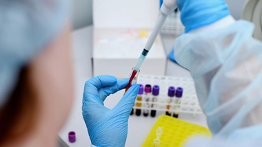 les analyses réalisées pendant les 20 mois qui ont suivi l’arrêt du traitement n’ont détecté ni particules virales, ni réservoir viral activable, ni augmentation des réponses immunitaires contre le virus dans l’organisme de cette personne.