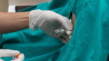 Urgences : quand faut-il faire une ponction lombaire ?