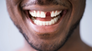 Testé sur des souris et des furets, ce médicament n'a entraîné aucun effet secondaire grave