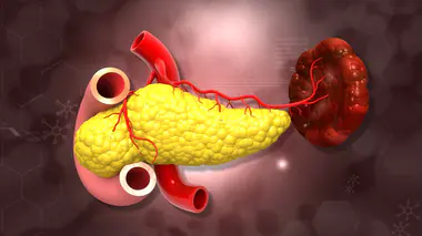 Cancer du pancréas : quels symptômes doivent alerter ?