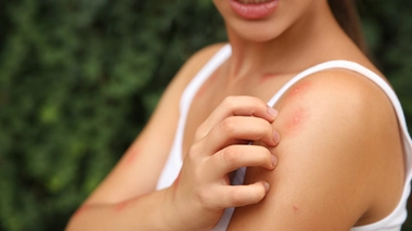 Le virus Usutu, comme le virus du Nil occidental, se transmet par les piqures de moustique.