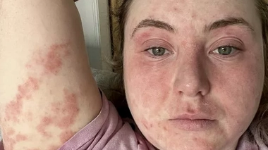 La jeune Écossaise avait déboursé plus de 1000 € pour obtenir un sourire parfait