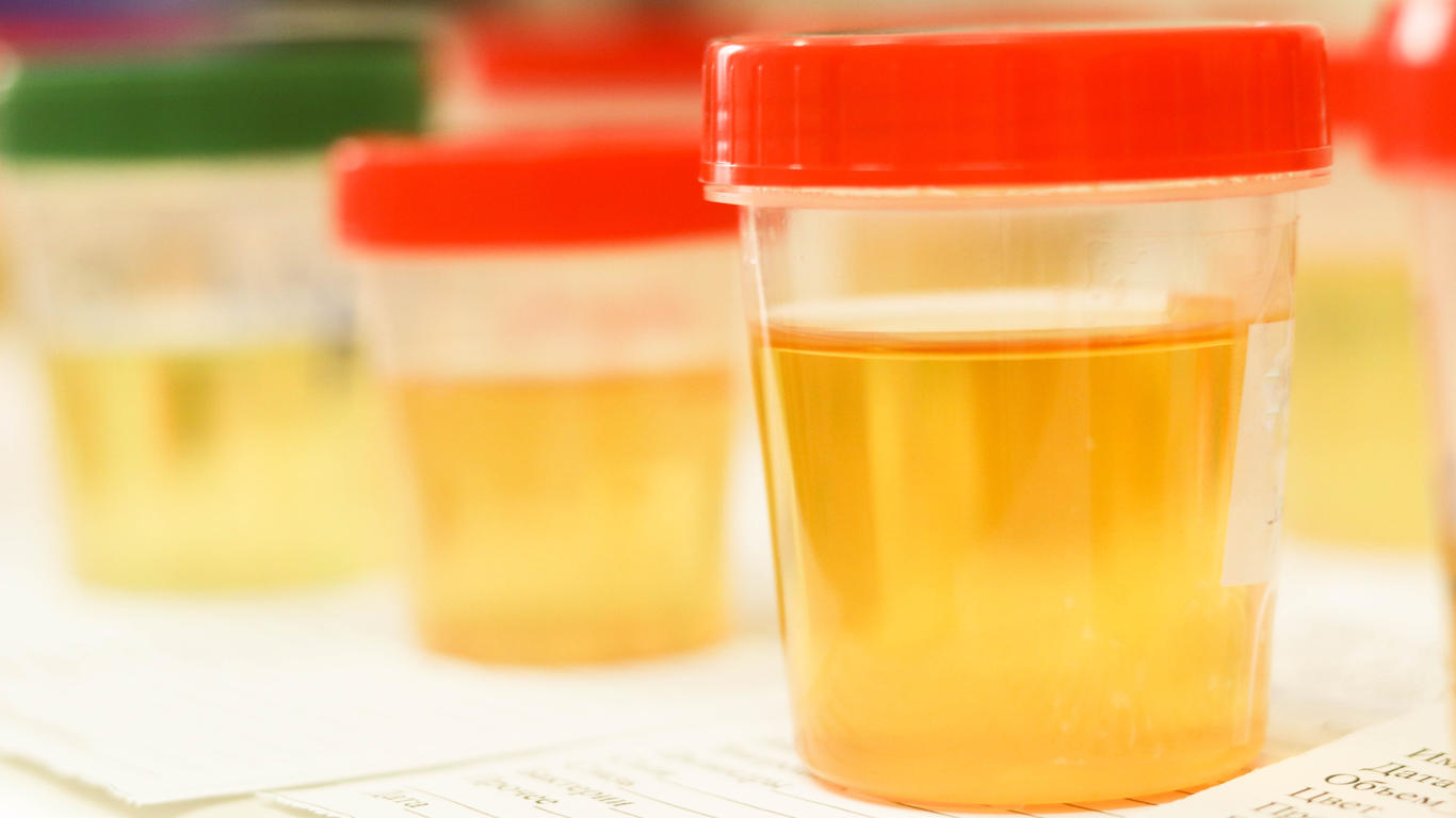 comment-votre-urine-pourrait-devenir-l-engrais-de-demain-allo-docteurs