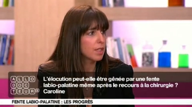 Fente labio-palatine : des séquelles après la chirurgie ?