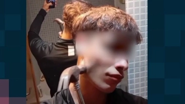 Bone smashing, une nouvelle tendance dangereuse sur TikTok