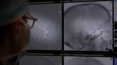 Enquête de santé : Vaincre l'AVC