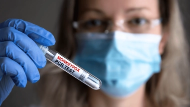 91 788 cas ont été confirmés depuis janvier 2022