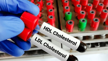 Il existe le "bon" cholestérol, ou cholestérol HDL, et le "mauvais" cholestérol, ou cholestérol LDL.