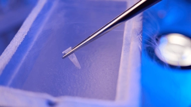 Âge, remboursement... Tout ce qu'il faut savoir pour congeler ses ovocytes