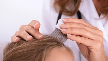 Les poux sont des parasites qui se logent en général sur la tête et se nourrissent de sang.