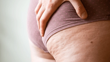 Crèmes, massages, radiofréquence, alimentation, sport… La cellulite touche près de 90 % des femmes, minces ou en surpoids.