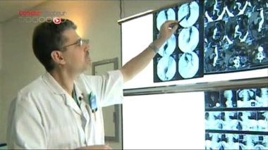 Anévrisme de l'aorte : et si c'était les gencives ?