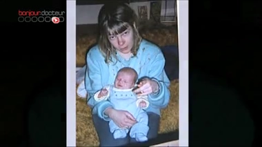 Syndrome de Di George : une maladie aux multiples facettes