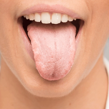 La mycose peut aussi toucher la bouche