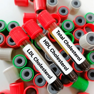Quelle est la différence entre le cholestérol LDL et HDL  ?
