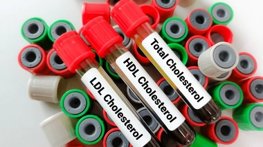 Quelle est la différence entre le cholestérol LDL et HDL  ?