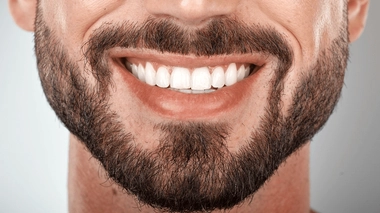 Dents blanches : attention aux dangereuses promesses des réseaux sociaux