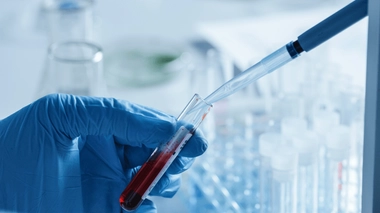 La maladie de Biermer peut se détecter au moyen d'une prise de sang