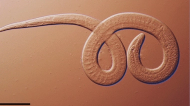 Le parasite en question est le Trichinella nativa, un ver s’attaquant au cerveau