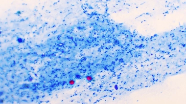 Les autorités sanitaires recommandent d'éviter tout rapport anal avec une personne ayant eu la diarrhée récemment