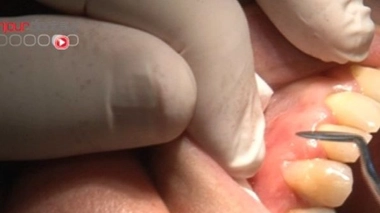 Les agriculteurs ne font pas le bonheur des dentistes