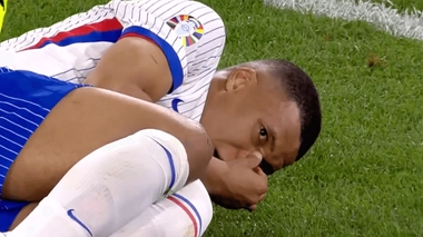 Une fracture du nez peut mettre 4 à 6 semaines à cicatriser après une opération