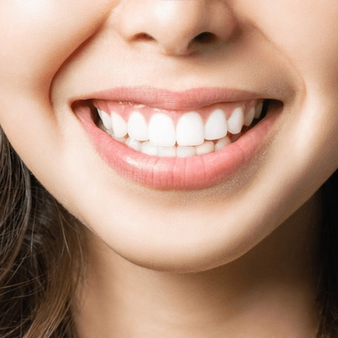 De nombreux soins dentaires permettent de conserver une bouche en bonne santé