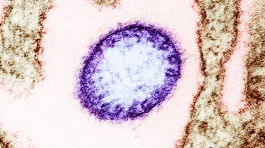 Cette maladie est apparue pour la première fois en Malaisie et à Singapour en 1998 et 1999