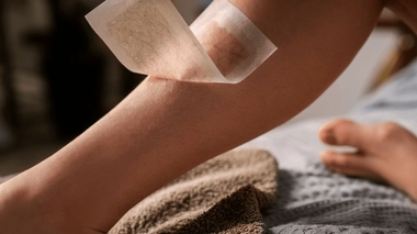 L'épilation à la cire peut favoriser les poils incarnés