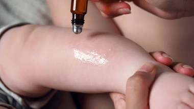 Comment soulager naturellement un coup de soleil ?