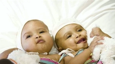 Des siamoises séparées avec succès