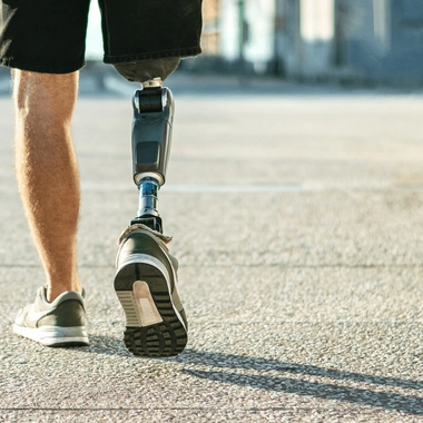 Le plus souvent, les causes d'amputation sont liées à un trouble cardiovasculaire