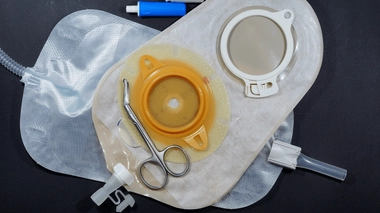 Comment vivre avec une stomie urinaire ?