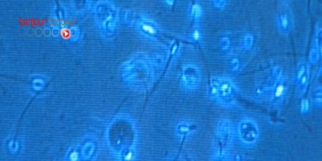 On estime qu'un garçon sur 500 nait avec un chromosome sexuel supplémentaire. Ce chromosome peut perturber la formation des spermatozoïdes.