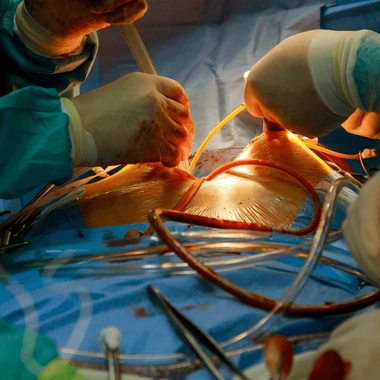 Le nombre de personnes en attente d'une greffe en France ne cesse d'augmenter 