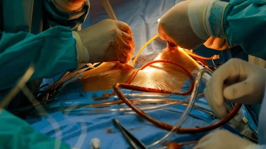 Le nombre de personnes en attente d'une greffe en France ne cesse d'augmenter 