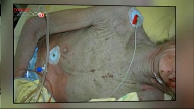 La gale débarque à l'hôpital