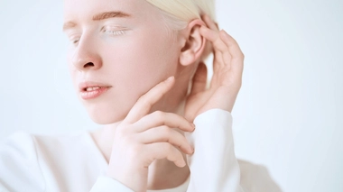 L'albinisme est dû à une anomalie génétique rare