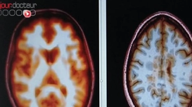 Recherche : ils lisent dans vos pensées