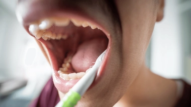 Si possible, privilégiez un brossage des dents régulier et une bonne hygiène bucco-dentaire