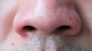 Notre nez produit près d'un litre de morve par jour