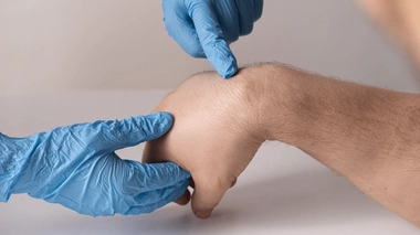 Un lipome est une tumeur du tissu gras