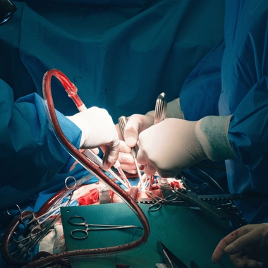 Comment limiter le risque de rejet d'un greffon