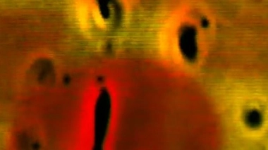 La résistance aux antibiotiques remonterait à l'Âge de glace !