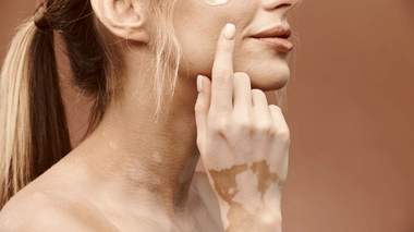 La nouvelle crème est très efficace pour les taches sur le visage