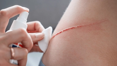 Quels antiseptiques et désinfectants sont les plus efficaces ?